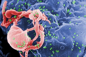 HIV-budding-Color 10